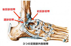 ３つの足関節外側靭帯