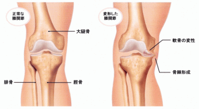 膝関節